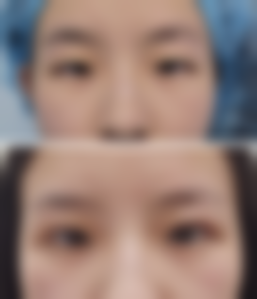 【广元芊后医疗美容医院特色项目：】