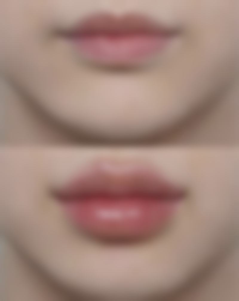 打瘦脸针要多长时间？仅需15 - 30分钟，快速变美不是梦，安全无痛效果显著！ 