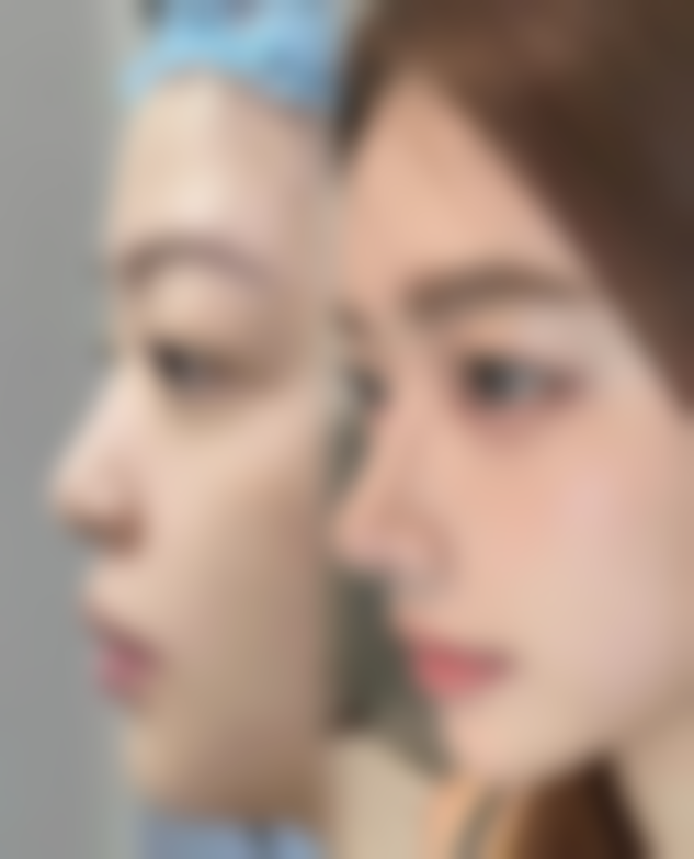 【广元芊后医疗美容医院患者口碑评价：】