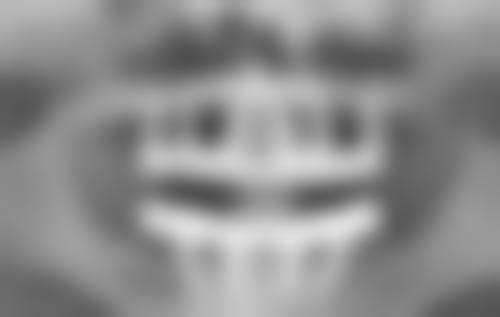 瘦脸针多少钱一次,要打几次定型