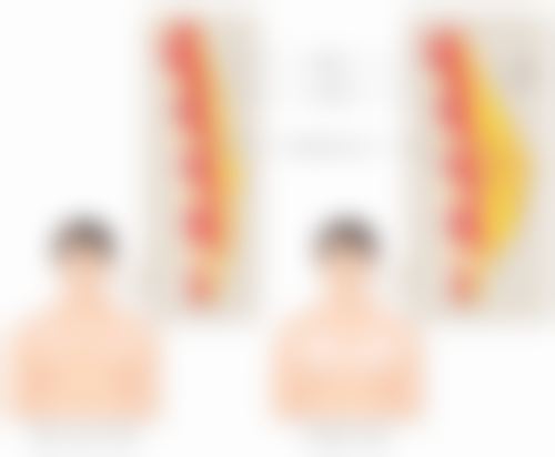 瘦脸针打一次维持多久