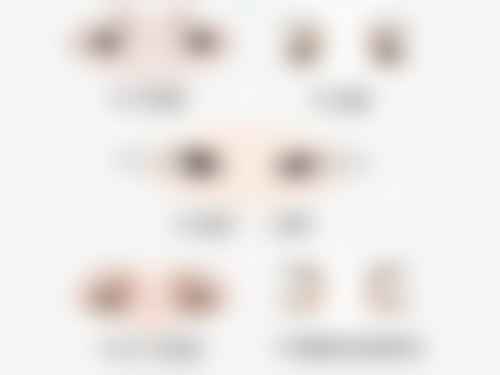 环切包皮手术钛钉多久能掉