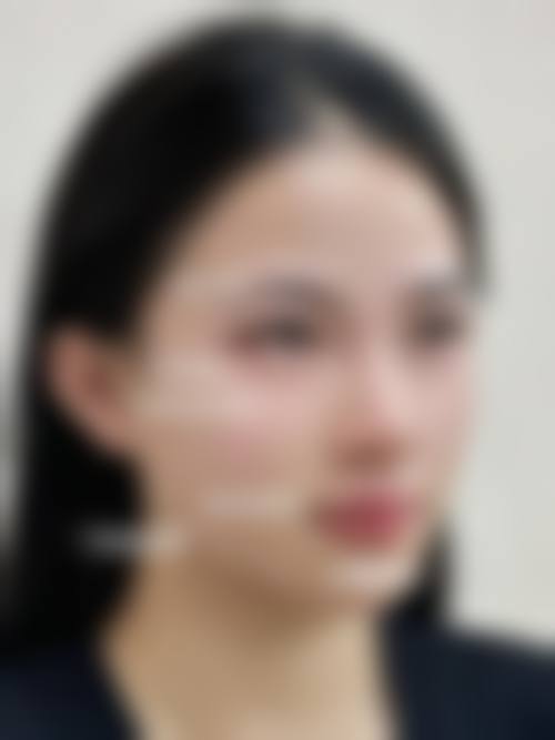 【呼和浩特尔娴整形核心优势：】