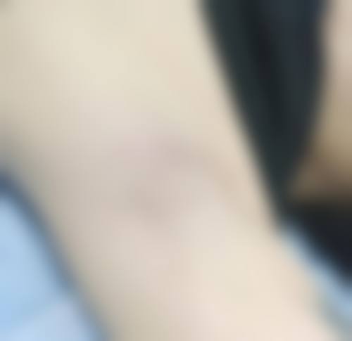 【魏运宏医生擅长项目：】