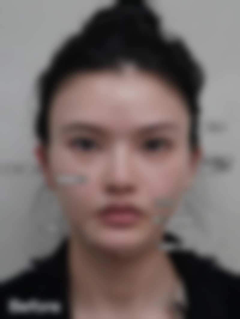 【卢星卫医生擅长项目】