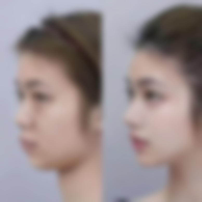 【深圳曙光医院医疗美容科参考价格表：】