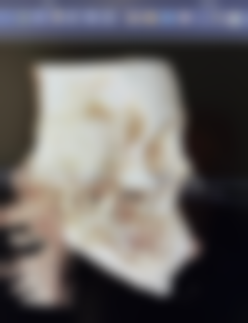 打了瘦脸针和下巴要注意些什