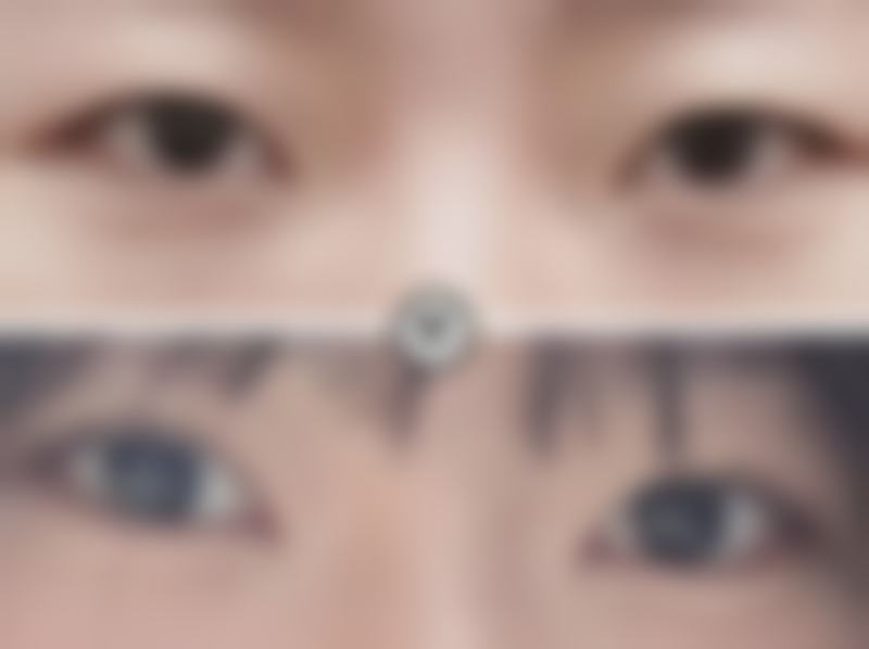 【泉州黄氏整形美容医院患者口碑评价：】