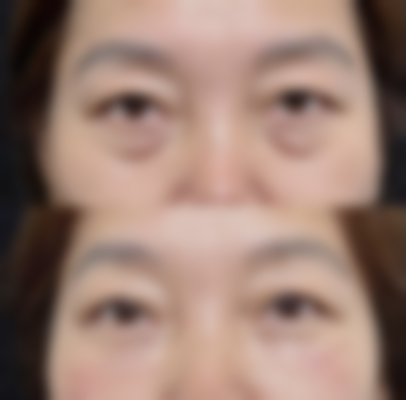 【呼和浩特尔娴整形怎么预约挂号?】