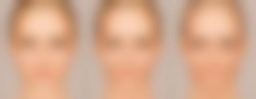 自体脂肪丰臀修复期多久可以运动