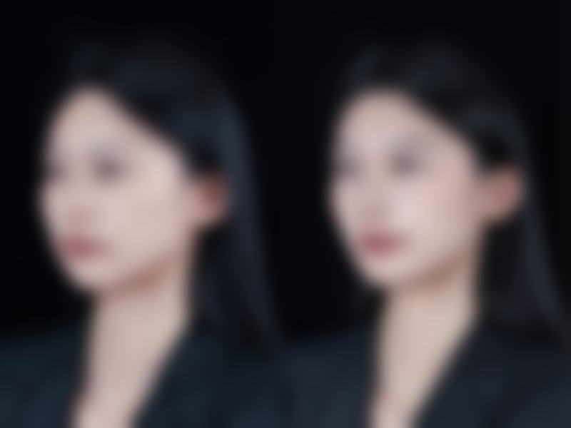 【曲靖市第一人民医院医学整形美容科怎么预约挂号?】