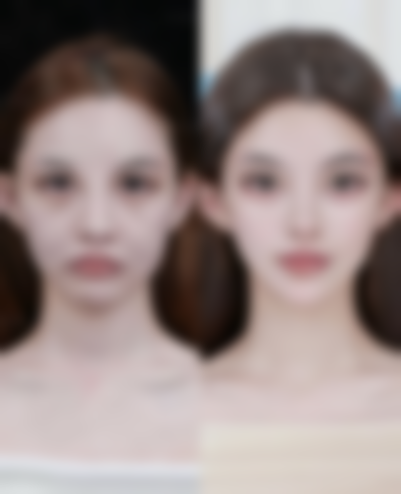 毛发种植技术好吗