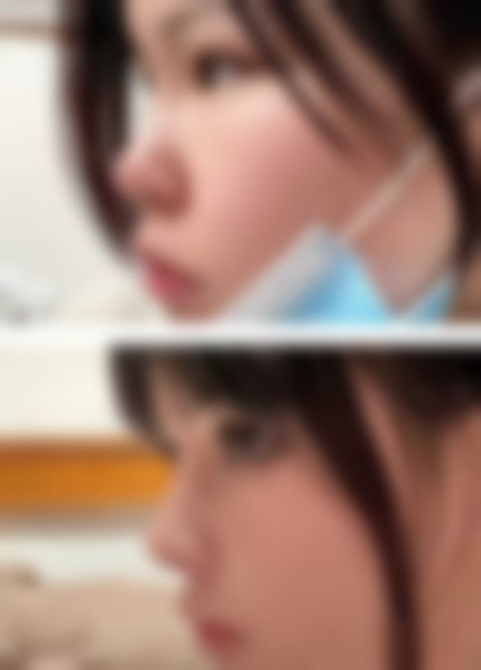 【长春瑞澳医学美容特色项目：】