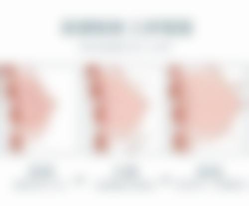 下巴后缩如何自我矫正