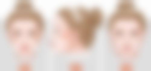 瘦脸针会皮肤松弛吗？权威揭秘：正确注射瘦脸针不仅不松弛，还能让你年轻5岁焕颜紧致！ 