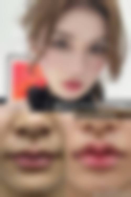 【镇江嘉拾整形医院患者口碑评价：】