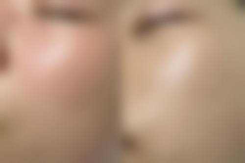 【芜湖市第二人民医院(整形美容外科)患者口碑评价：】