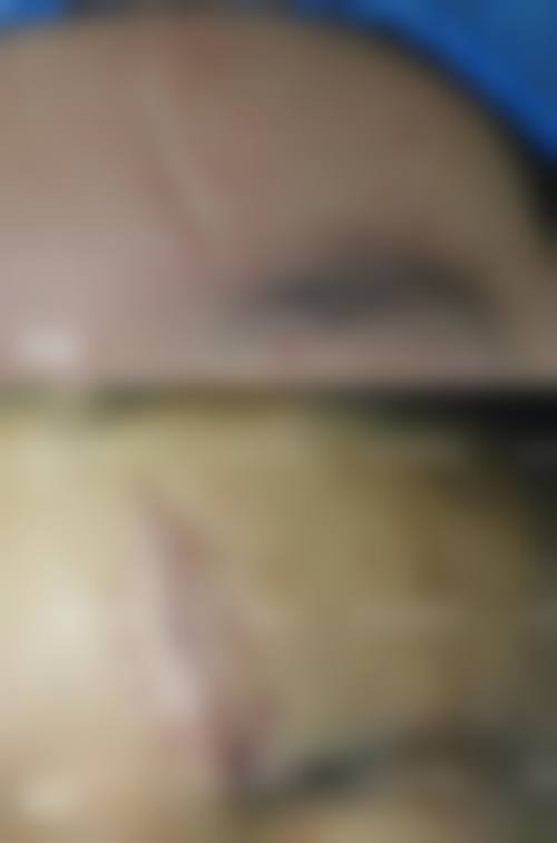 【徐州美玲医学整形美容诊所特色项目：】