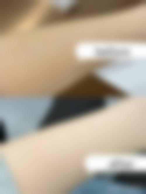 【王晓雪医生擅长项目】