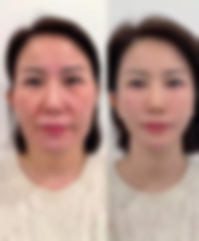 【镇江嘉拾整形医院参考价格表：】