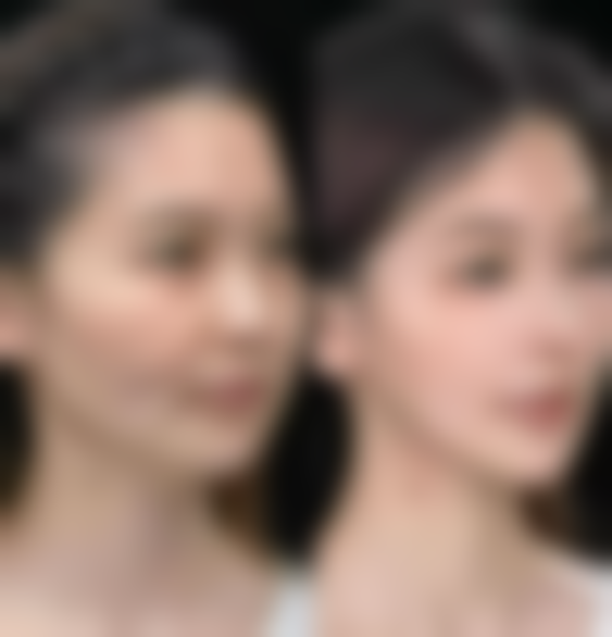 【金荣权医生擅长项目】