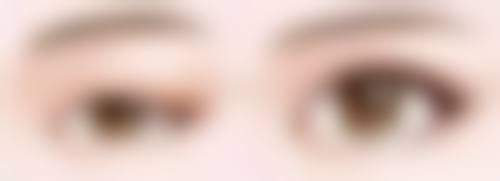 【韩国尤美医院是正规的吗?】