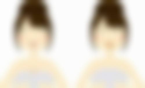 吉适(Dysport)——大面积除皱的能手