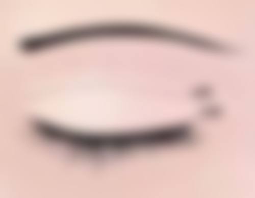 美白针多久打一次成效好