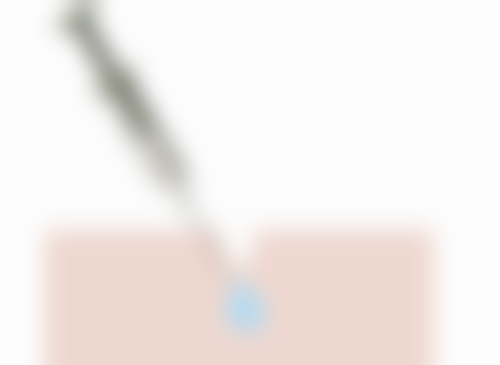 阴道紧缩术多久可以洗澡