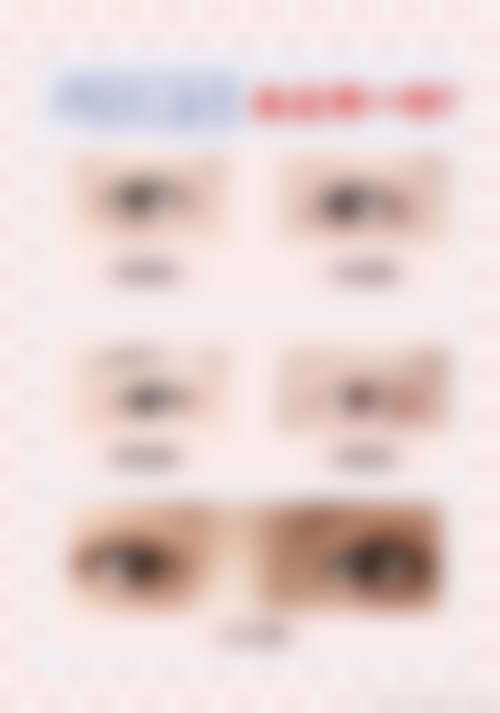 患者B：“我来这里做传统吸脂瘦大腿，整个过程非常顺利。医生的技术特别娴熟，术后的成效也特别明显，大腿瘦了好多。而且医院的服务特别贴心，术前术后都有专人跟进，让我特别放心。”