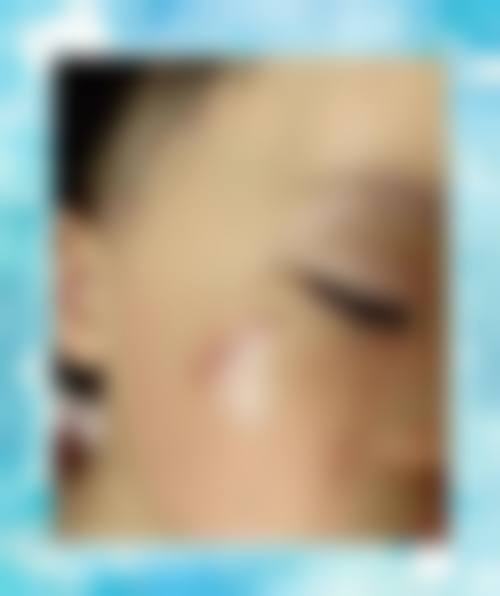 患者C：“我做了激光脱毛，成效超出了我的预期。医院的设备特别精良，脱毛过程几乎没有疼痛感，而且医生的操作特别专精。现在我的皮肤变得光滑了特别多，真的太感谢AND整形外科了！”