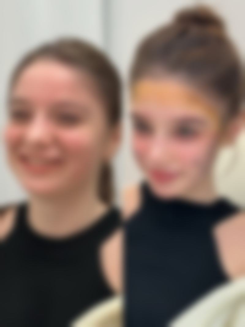 瘦脸针能否恒久定型