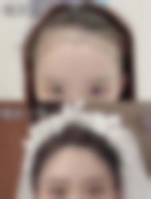 其他除皱针品牌介绍