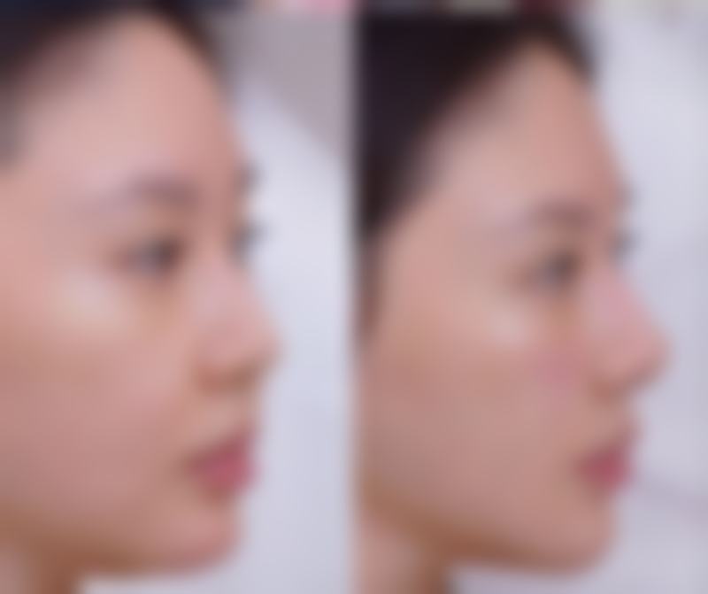 伊婉致柔——天然温和修复