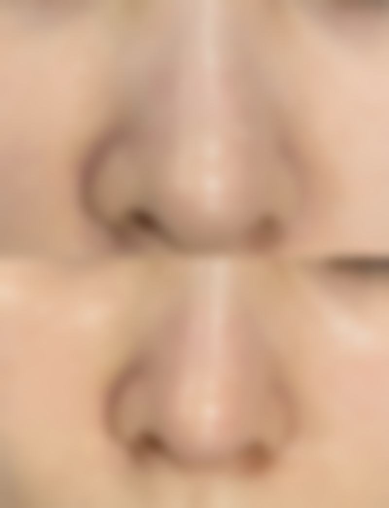 美白针一般多久见效