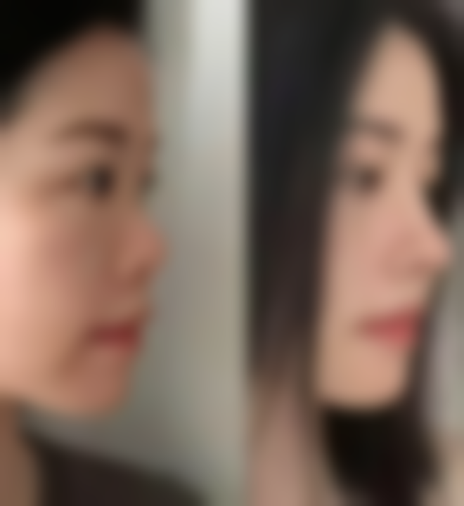 【武汉九州丛琳医疗美容医院参考价格表：】