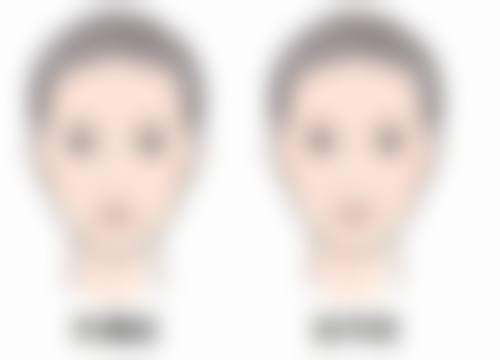 美白针多久打一次成效好