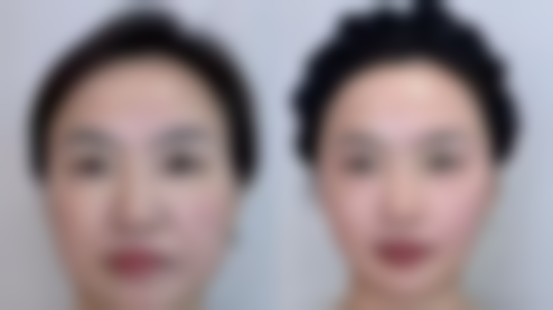 【北见SkinClinic诊疗设备：】