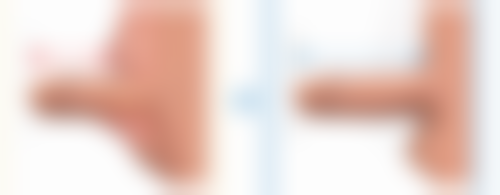 日常唇部护理注意事项