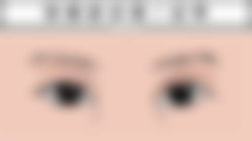 嘴唇疤痕能修复好吗?