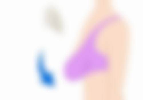 嘴唇疤痕怎样消除更有效?