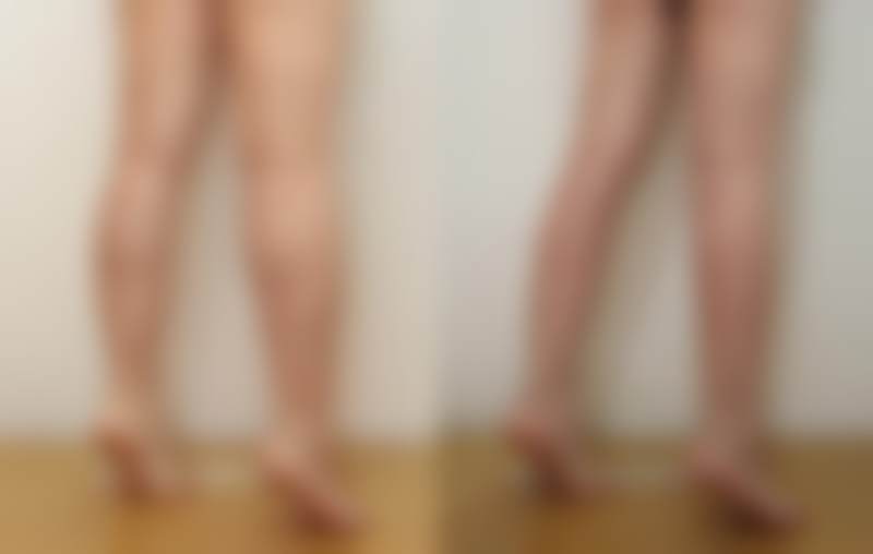 韩国sage医院李敬秀的抗衰管理真实反馈好不好？