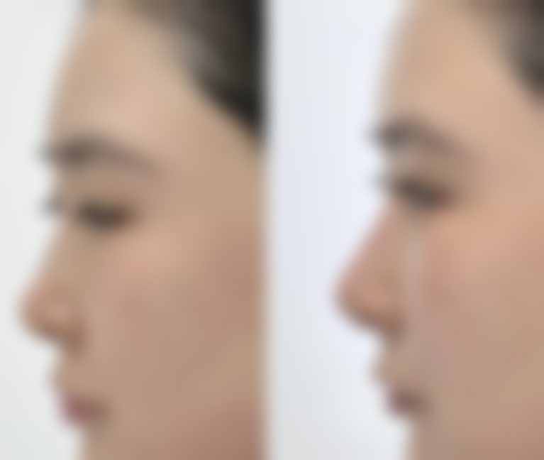 武汉艺星医疗美容医院在湖北省正规医美医院名单中适合做面部年轻化治疗吗？