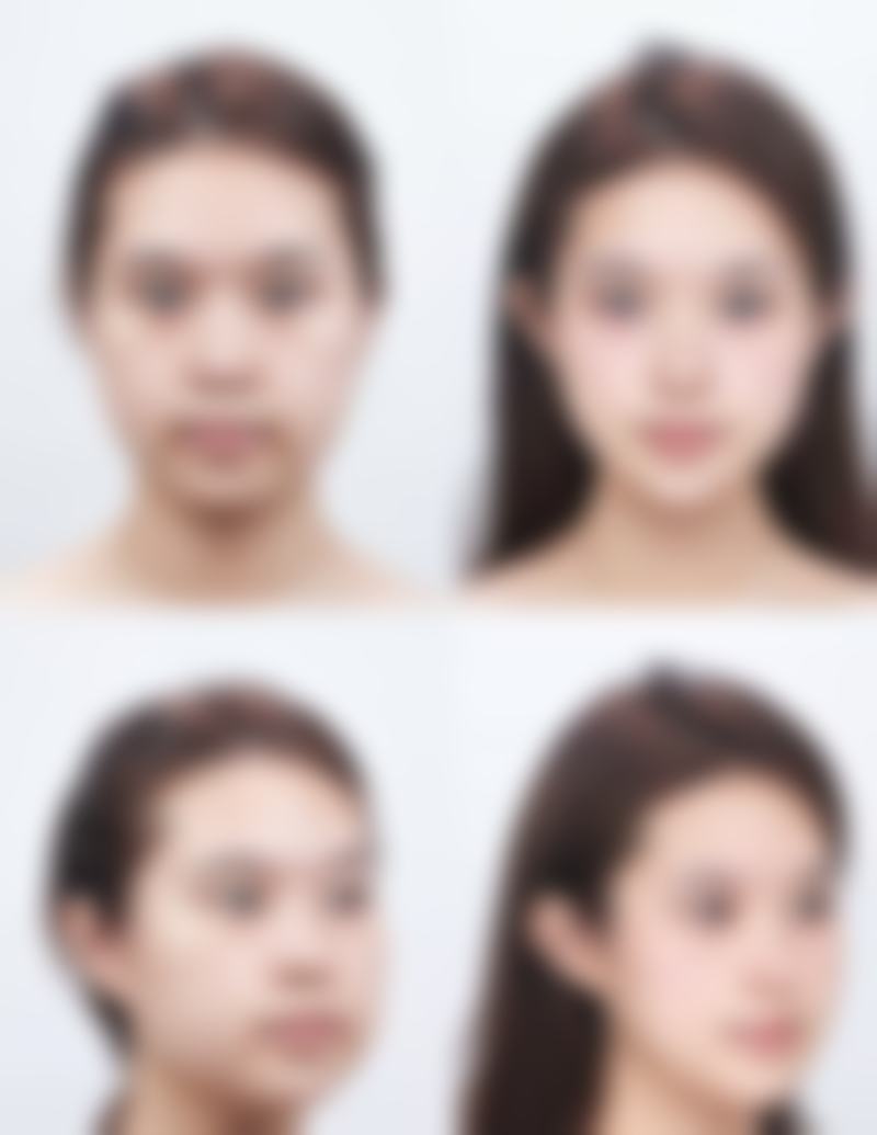 【ES清潭医院患者口碑评价：】