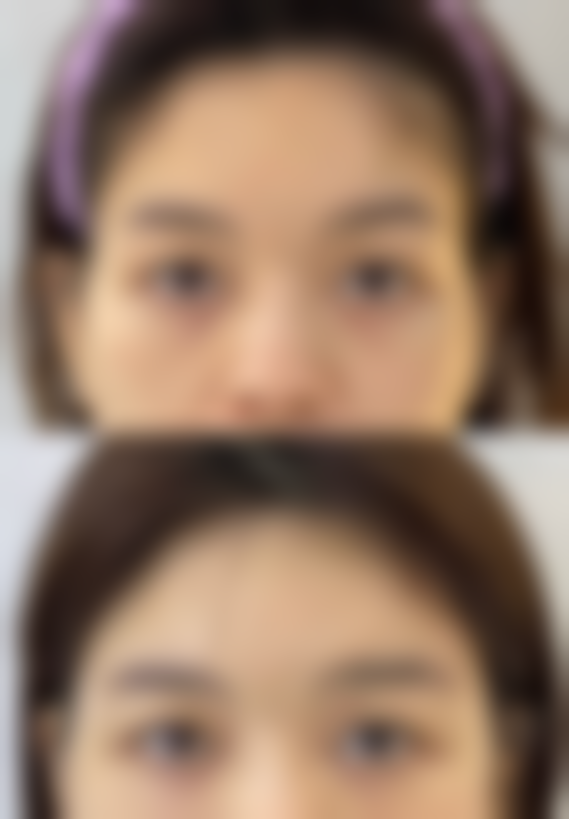 【韩国springeye皮肤科地址：】