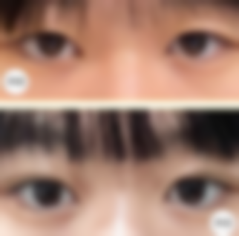 【温州迪贝雅整形医院患者口碑评价：】