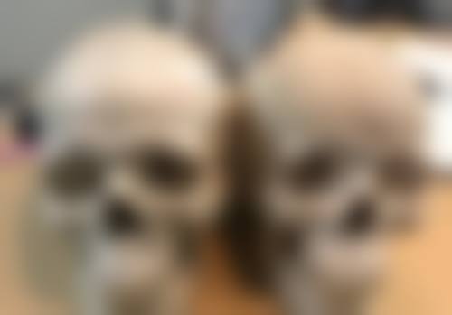 种植头发多少钱