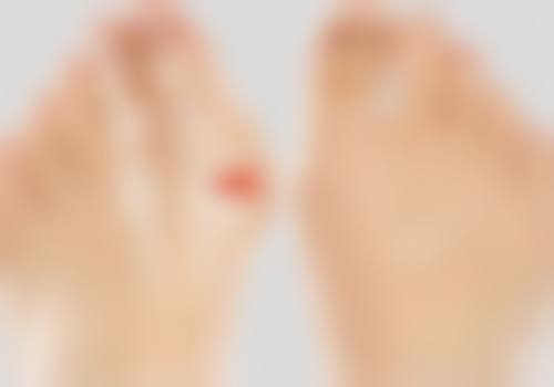 打完瘦脸针脸肿吗？揭秘瘦脸针后脸部肿胀真相，7天消肿秘诀让你轻松变美！ 