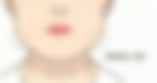 种植头发大概多少钱