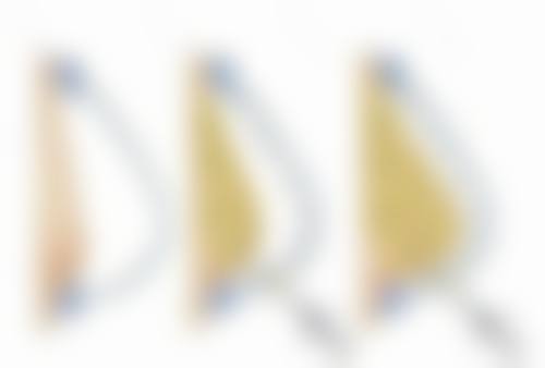 瘦脸针打完多久见效